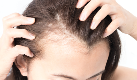 Does acupuncture help with hair loss?