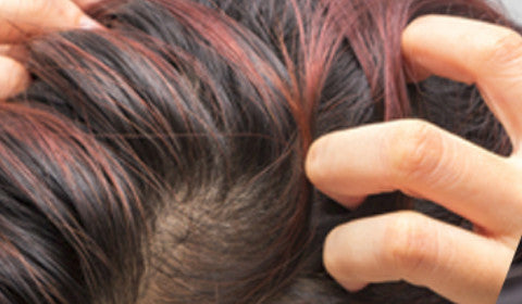 The connection between an itchy scalp and hair loss
