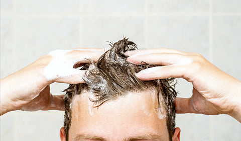 Do anti-dandruff shampoos cause hair loss?