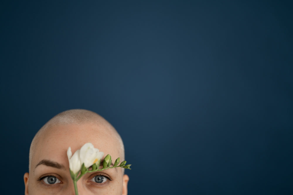 Measuring female pattern baldness with the Ludwig Scale