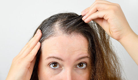Hair loss in women due to traction alopecia